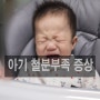 아기 철분부족증상 활동량 많은 성장기 어린이 키즈철분영양제