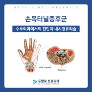 엄마의 직업병 손목터널증후군! 손목내시경 통해