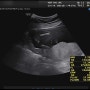 임신일기[16주 2일 2차 기형아 검사]