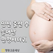 임신 출산 후 늘어난 편평사마귀 레이저치료 [명동역피부과-고운세상]