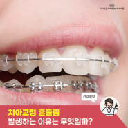 치아교정 후에 흔들림은 왜 발생할까요?