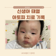 신생아 태열에서 아토피 치료 육아 기록 4개월차 아기