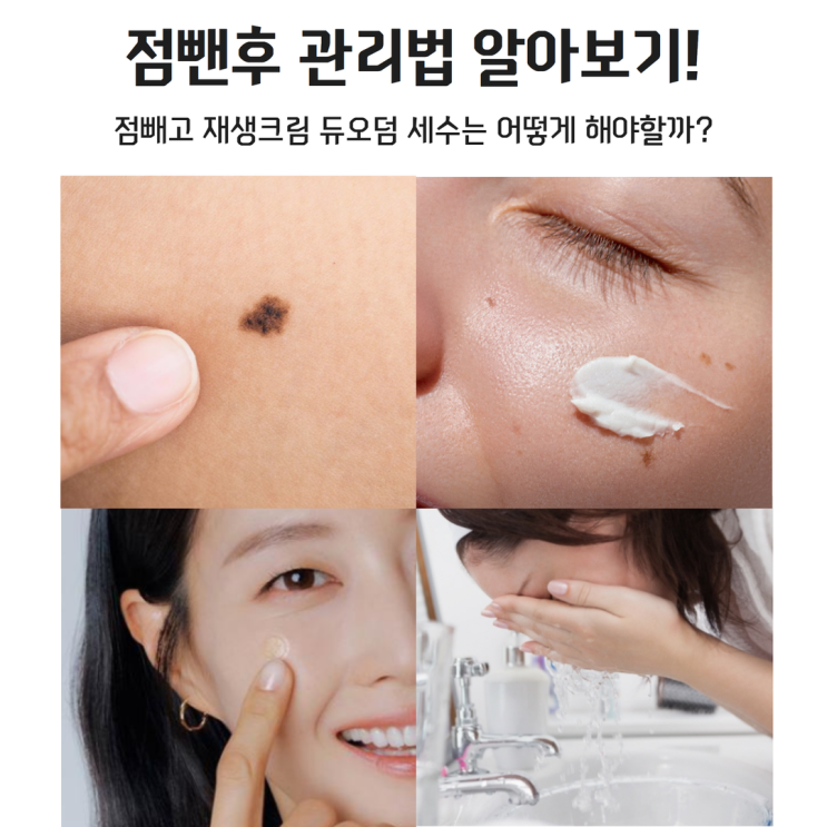 점뺀후 관리법 점빼고 재생크림 듀오덤 세수는 어떻게 해야할까 : 네이버 블로그