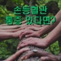 안양삼성흉부외과[하지정맥류]-손등에 튀어나온 혈관이 걱정이 됩니다!