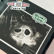 [임신기록 4~8주] 계류유산 후 이란성 쌍둥이 자연임신, 초음파, 입덧, 심장소리, 초기 주의사항