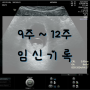 [9주~12주 임신기록] 임신 초기 증상 / 기초검사(모성검사 10종) / 씬지로이드 복용 / 1차 기형아검사 / 임신 초기 피비침