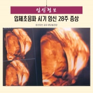 입체초음파 시기 사진 임신 28주 증상