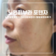 [노원피부과]노원포텐자/펌핑포텐자후기/50대포텐자효과/엄마효도 피부시술><