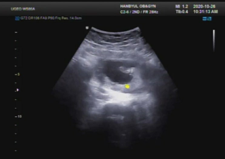 배란일계산기 가임기 뜻 임신확률 배란기 냉 증상 임신가능성 : 네이버 블로그