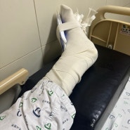 발가락 골절 수술 후기 ⑤ 회복 꿀팁, 추천템 및 필수템