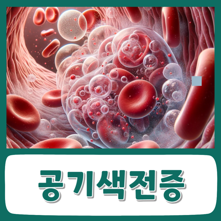 공기 색전증 증상 원인 치료 정맥 주사 : 네이버 블로그