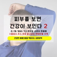 피부건강이야기 2탄