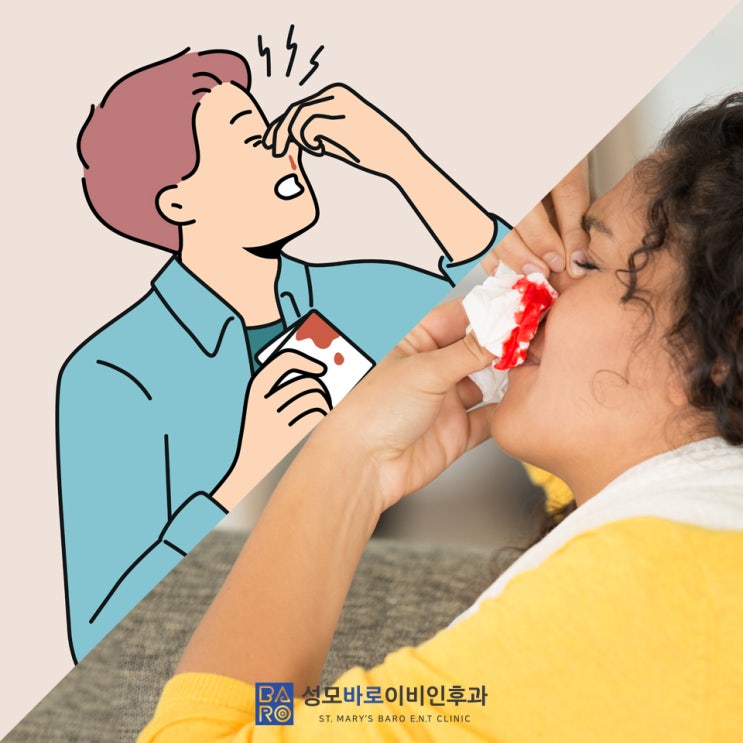 코피날때 응급처치 방법 침착함이 필요해 : 네이버 블로그 코피날때 응급처치 방법 침착함이 필요해 : 네이버 블로그