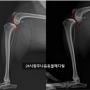 강아지십자인대 파열, TPLO 수술 (청주24시나음동물메디컬)