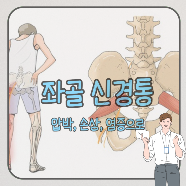 좌골신경통 원인과 검사하면 치료 가능할까? : 네이버 블로그