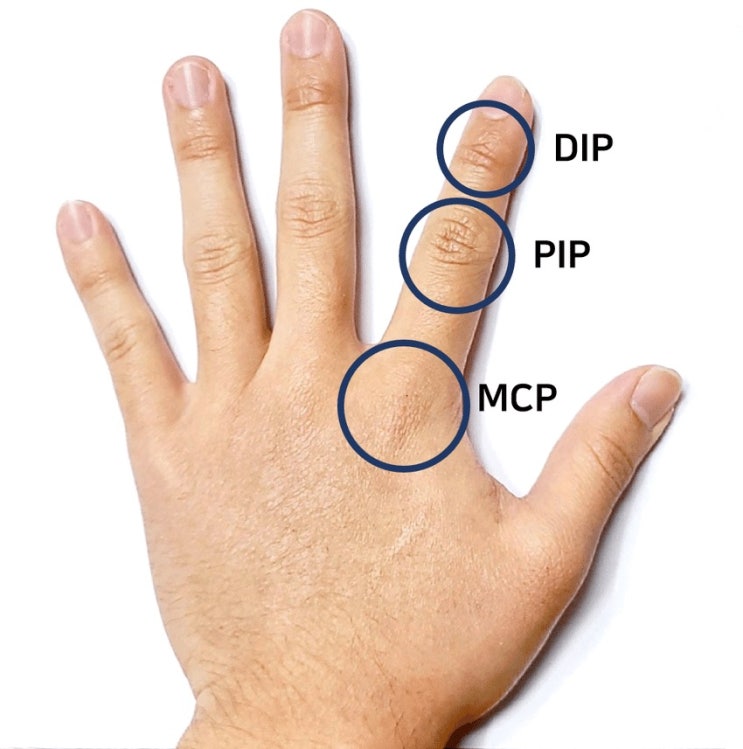 신대방PT 관절의 운동] 손가락 운동 (근위 지절간관절 PIP joint, 원위 지절간관절 DIP joint) : 네이버 블로그