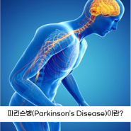 파킨슨병(Parkinson's Disease)이란?