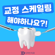 치아교정 중 스케일링의 필요성?!