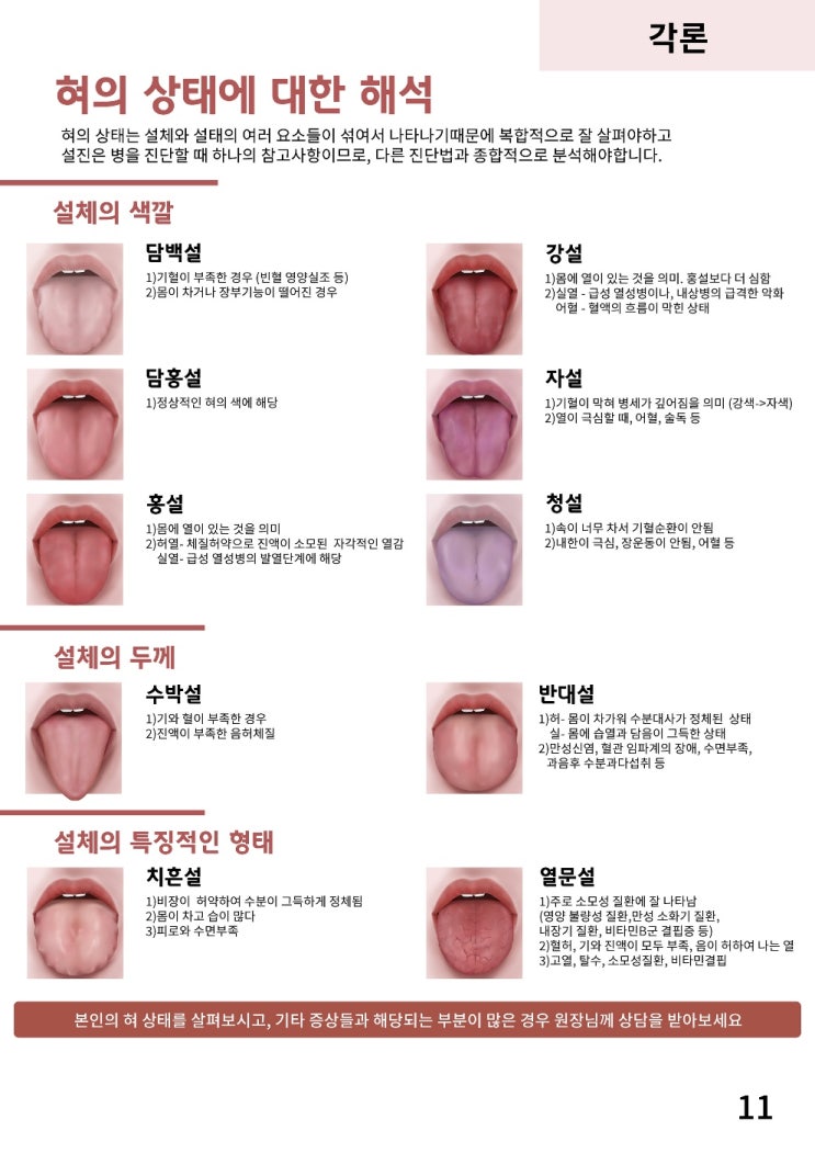 신림역 근처 한의원 미담 경희 한의원과 살펴보는 설진 해석편 : 네이버 블로그