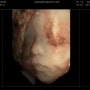 [임신 27,28주차] 3D입체초음파, 임신성당뇨검사, 진료결과