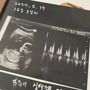 임신 16주 초음파 2차기형아검사 성별 대전 더블유여성병원