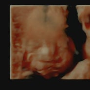 [쌍둥이 임신 기록 #5] 29주차 증상, 임산부 코로나, 쌍둥이 입체초음파 후기