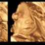 [임신 26-28주 일기] 너무 귀여운 쩐돌이 얼굴 공개 (입체초음파)