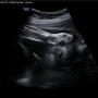 [임신 31주, 32주] 손가락 부종 손목 통증 / 백일해 접종 / 평택 라움산부인과
