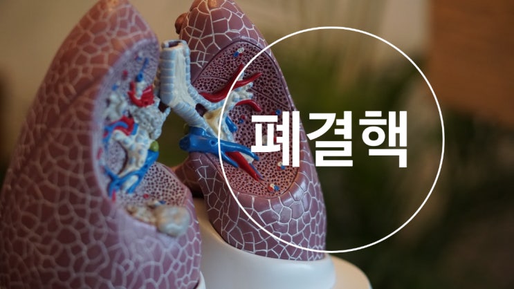 폐결핵 원인과 증상 : 네이버 블로그