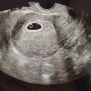 [임신일기] 임신 초기 6~16주