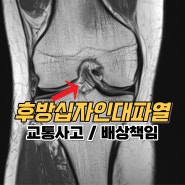 후방십자인대파열로 보험보상 잘 받기 위해서 해야할일