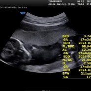 [임신일기] 임신중기 17~28주