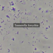 Tannerella forsythia