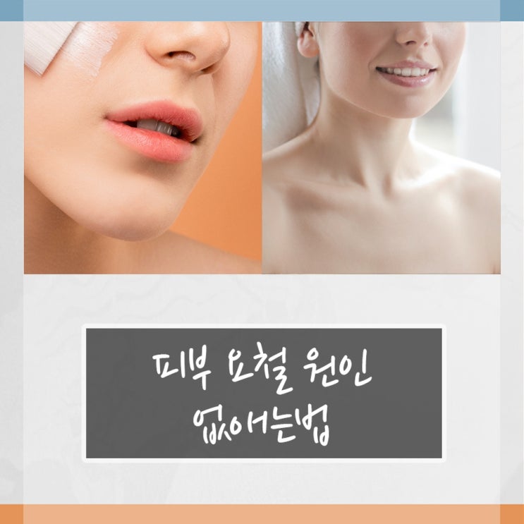 피부 요철 원인 및 없애는법 : 네이버 블로그