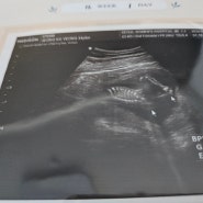 [임신일기] 임신 16주 기형아검사 통과, 조리원 예약 완료, 성별확인