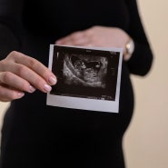 태아 성별고지 금지 의료법 조항 위헌 선고