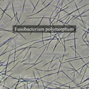 Fusobacterium nucleatum subsp. polymorphum