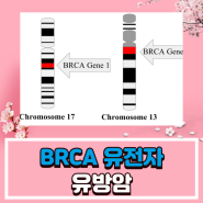 브라카유전자(BRCA 유전자)와 유방암 유전