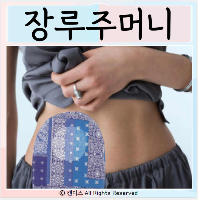 장루주머니 위치 종류 위생관리 비우는법 : 네이버 블로그