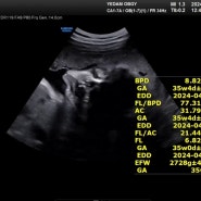 [임신일기] 임신 후기 36~37주
