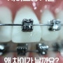 치아교정 기간 왜 차이가 날까요? :: 풍무동치과 교정