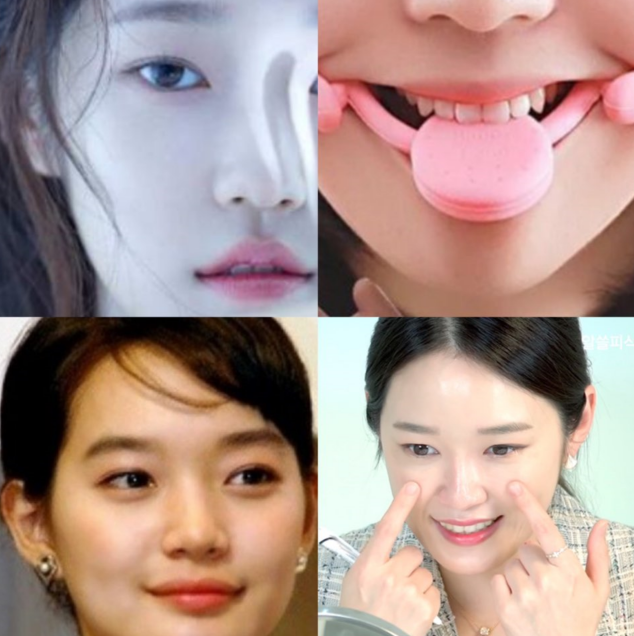 미소교정기 입꼬리 올리는 운동 : 네이버 블로그