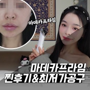 이보영 뷰티디바이스 마데카프라임으로 셀프 홈케어 피부 관리 찐후기 & 최저가 공구