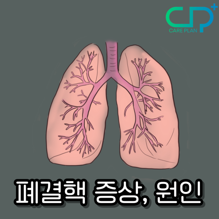 폐결핵 증상, 원인 진단방법 : 네이버 블로그