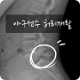 [부천재활] 야구선수 허리재활(척추분리증/전방전위증) 후기
