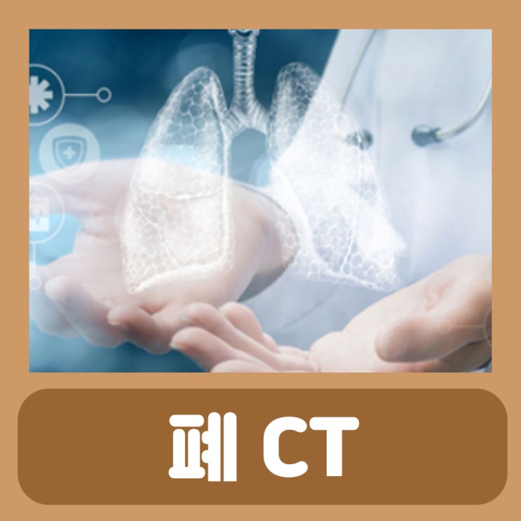 폐 CT 혹 간유리음영 고립성 페결절, 저선량 폐CT 폐암 초기 : 네이버 블로그