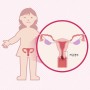 한국인에게 흔한 암 '자궁경부암' 인포그래픽 (2024)