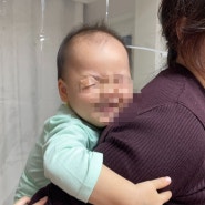 아기 눈옆 상처 24시간 지나서 봉합 한강수병원(상처 사진 있음)