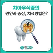 경산 정평 치과, 치아우식증의 원인과 증상, 치료방법은?