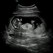 임신12주 태아모습 기록 (13주,14주 일기)